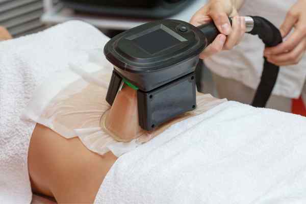 Areas of the Body we treat Cryolipolysis Birmingham