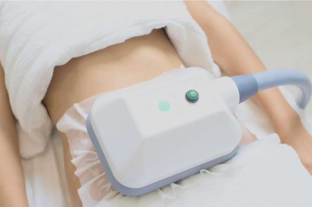 How Fat Freezing and HIFU Work Together? 3 advantages to combining Fat Freezing and HIFU Birmingham