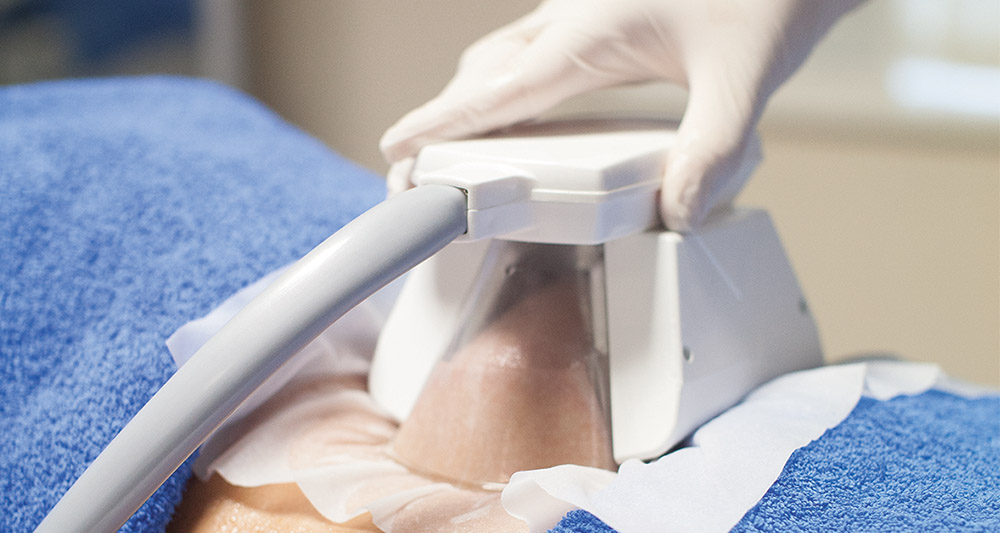 How Fat Freezing and HIFU Work Together? 2 Multiple Areas in One Session HIFU and Fat Freezing Birmingham