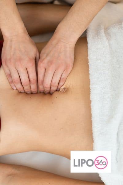 diastasis recti treatment Birmingham