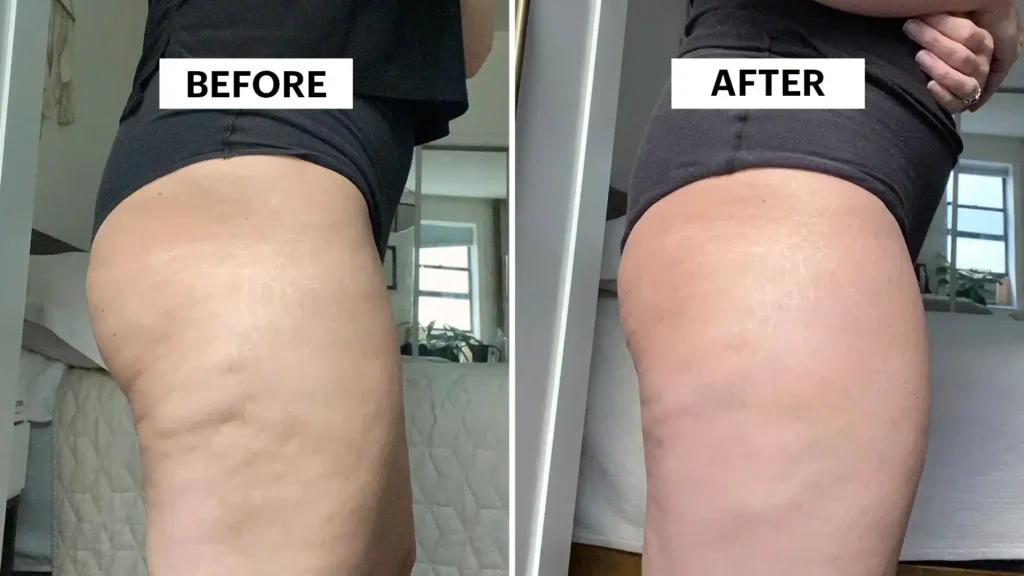 Do Toning Exercise Birmingham Really Tackle Cellulite?