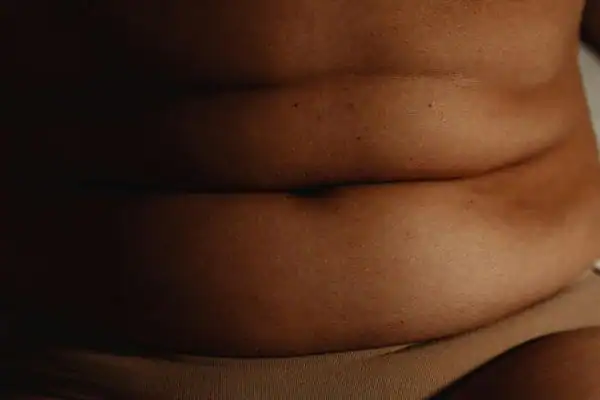 The Hidden Connection: How Stress Shapes Your Fitness and Body Composition 3 image of what stress can do on the stomach area and how Lipo 360 Birmingham can help to change your body shape.