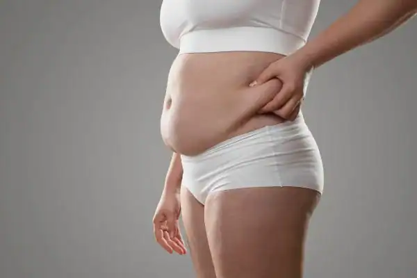 Image of stress belly Birmingham How Lipo 360 can help manage your symptoms